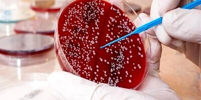 سرطان خون در جوانی به معنای طول عمر کوتاه تر است