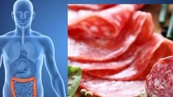 سالانه ۲ میلیون نفر در دنیا به سرطان روده مبتلا می‌شوند