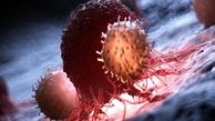 غربالگری ۳ سرطان شایع در ایران / ورود به سرطان‌های دیگر به شرط تامین اعتبار
