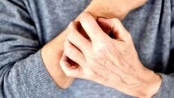 چگونه خشکی پوست را کاهش دهیم؟
