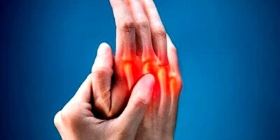 علائم روماتیسم مفصلی چیست؟