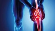 چگونه از دردهای مفصلی پیشگیری کنیم؟
