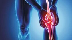 چگونه از دردهای مفصلی پیشگیری کنیم؟
