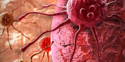 مردان این علائم هشداردهنده سرطان را جدی بگیرند