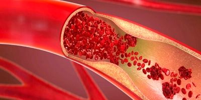 ارایه خدمت اورژانس تهران به ۴۳۰۰ مصدوم در ایام جنگ