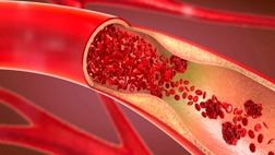 روش‌های اورژانسی پیشگیری از خونریزی در مجروحان
