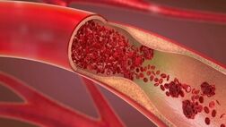 روش‌های اورژانسی پیشگیری از خونریزی در مجروحان
