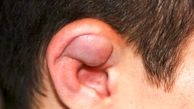 سرطان لاله گوش چیست و چه علائمی دارد؟
