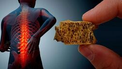 بیشترین تراکم استخوانی در ۳۰ تا ۳۵ سالگی