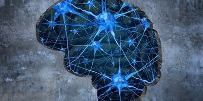 مصرف قند بر ریسک بیماری آلزایمر تاثیر دارد