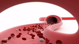 پلاکت خون پایین چیست و چقدر می‌تواند خطرناک باشد؟
