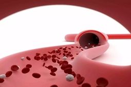 پلاکت خون پایین چیست و چقدر می‌تواند خطرناک باشد؟
