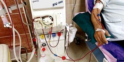 تعداد بیماران خاص تحت پوشش صندوق بازنشستگی کاهش یافت 