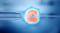 هزینه IVF با بیمه تامین اجتماعی ۱۴۰۴ چقدر است؟