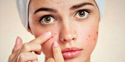  صورتتان درباره سلامتی شما چه می گوید؟ 