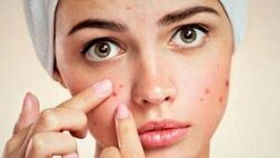  صورتتان درباره سلامتی شما چه می گوید؟ 