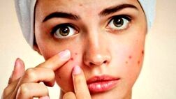  صورتتان درباره سلامتی شما چه می گوید؟ 