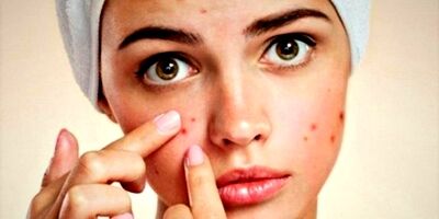  صورتتان درباره سلامتی شما چه می گوید؟ 