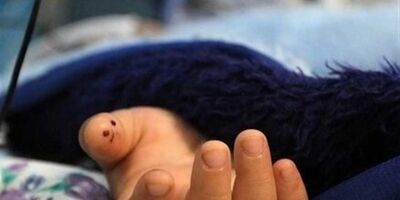 بازی مرگبار پسر ۱۲ساله با تفنگ ساچمه‌ای