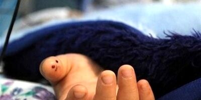 بازی مرگبار پسر ۱۲ساله با تفنگ ساچمه‌ای