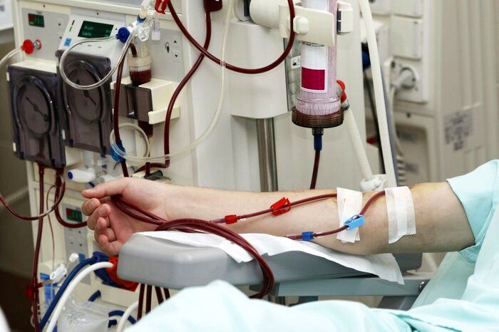افزایش میزان پاداش اهدا کنندگان کلیه به یک هزار و ۱۰۰ میلیون ریال