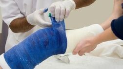 چگونه به فرد قطع عضو شده کمک کنیم؟