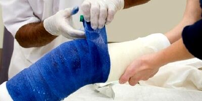 چگونه به فرد قطع عضو شده کمک کنیم؟