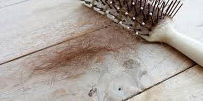 دلایل ریزش موی جلوی سر در زنان
