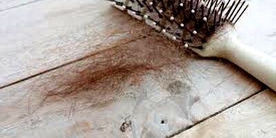 دلایل ریزش موی جلوی سر در زنان
