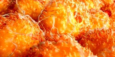 هر دو نوع دیابت ریسک زوال عقل را افزایش می دهند
