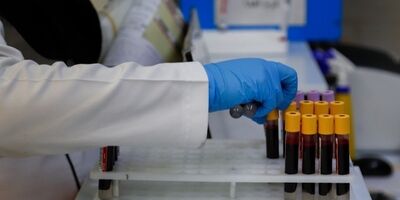 ذخیره بیش از ۳۵۰ واحدخون نادر در ایران
