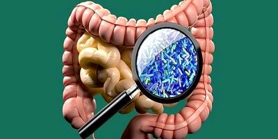 میکروبیوم های روده در بروز عفونت HIV نقش دارند