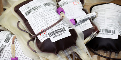 درخواست خون در بیمارستان ها ۴۰ درصد افزایش یافت