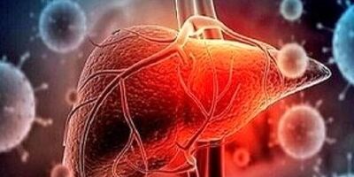 این نوشیدنی قاتل کبد است