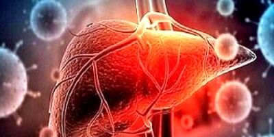 این نوشیدنی قاتل کبد است