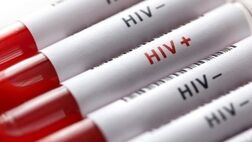 ۴۵ هزار و ۴۶۳ نفر در کشور مبتلا به HIV هستند