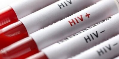 ۴۵ هزار و ۴۶۳ نفر در کشور مبتلا به HIV هستند