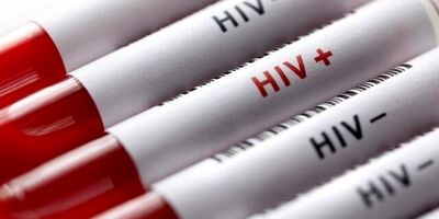۴۵ هزار و ۴۶۳ نفر در کشور مبتلا به HIV هستند