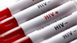 ۴۵ هزار و ۴۶۳ نفر در کشور مبتلا به HIV هستند