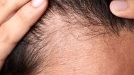 چگونه از آسیب‌دیدگی موها پیشگیری کنیم؟
