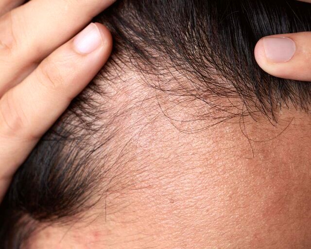 چگونه از آسیب‌دیدگی موها پیشگیری کنیم؟
