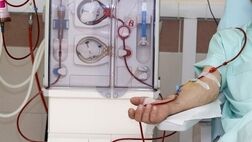 تجهیز مراکز دیالیز چهار کشور خارجی به دستگاه همودیالیز ایرانی
