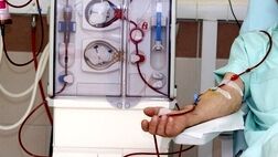 تجهیز مراکز دیالیز چهار کشور خارجی به دستگاه همودیالیز ایرانی