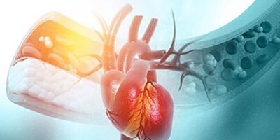 استرس احتمال فیبریلاسیون دهلیزی را در زنان یائسه افزایش می دهد