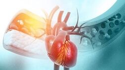 استرس احتمال فیبریلاسیون دهلیزی را در زنان یائسه افزایش می دهد