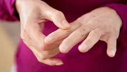 سندرم متابولیک ریسک ابتلا به نقرس را افزایش می دهد