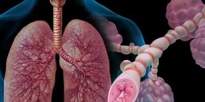 شیوع ۹ درصدی علائم آسم در بزرگسالان / تاثیر حیوانات خانگی بر شدت بیماری
