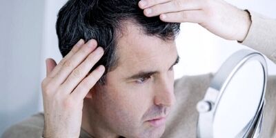 ۴ علت مهم سفید شدن زودهنگام رنگ مو‌ها