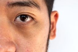 «چشم پاندایی» چیست؟
