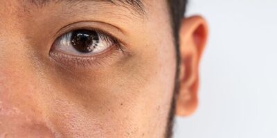 «چشم پاندایی» چیست؟
